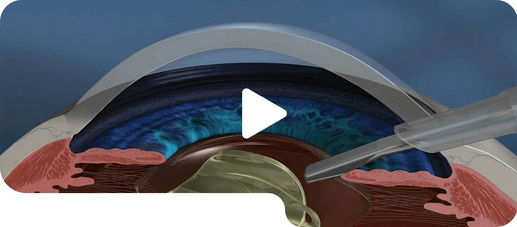 Tear film assessment