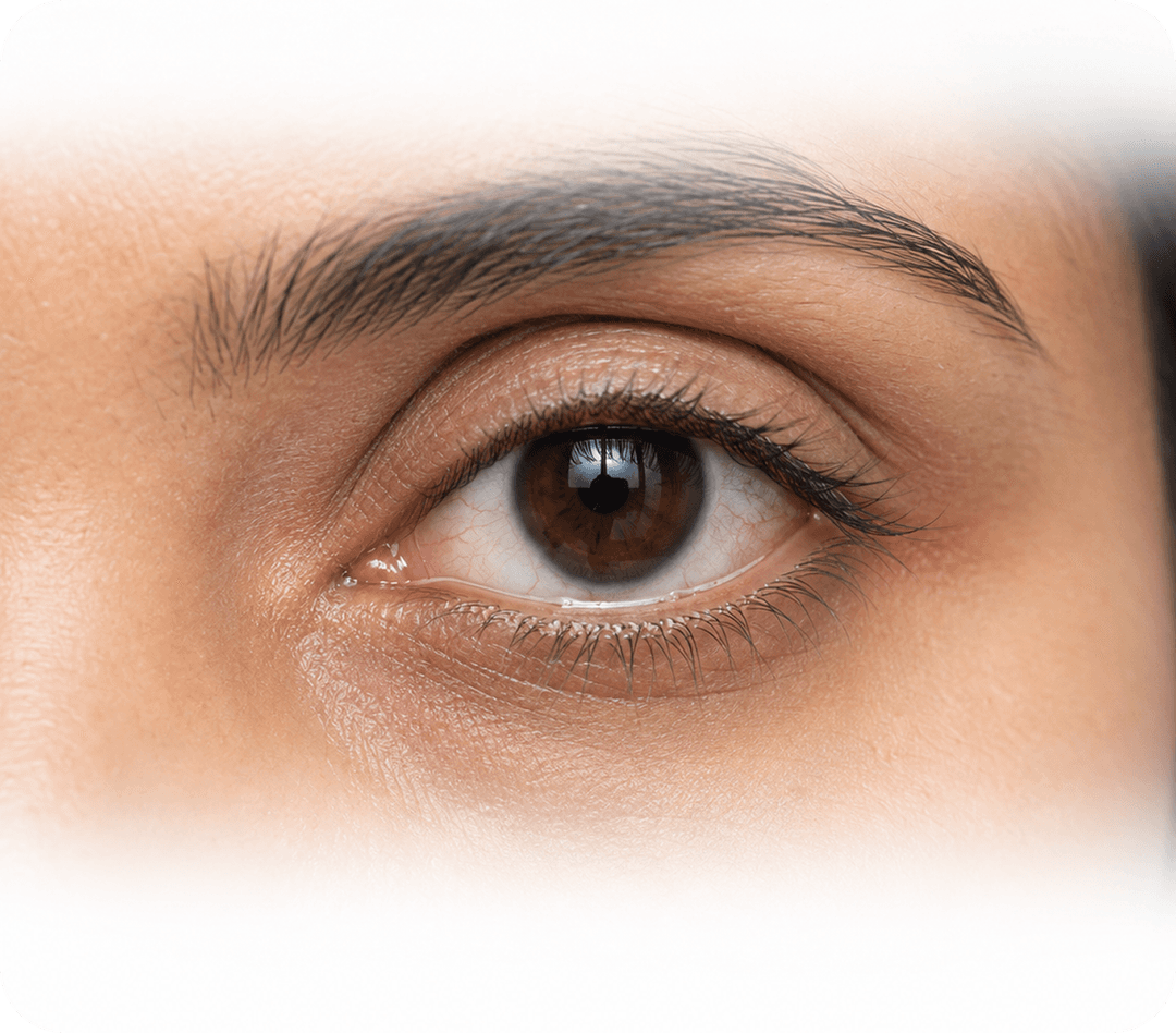 Mixed Dry Eye