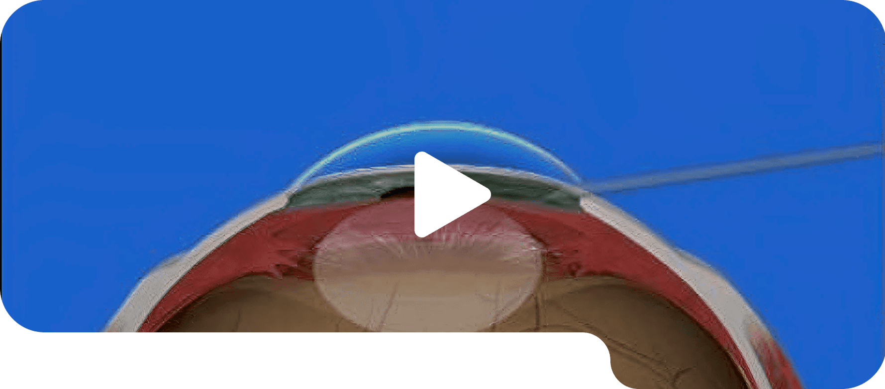 Pupil Dilation Exam
