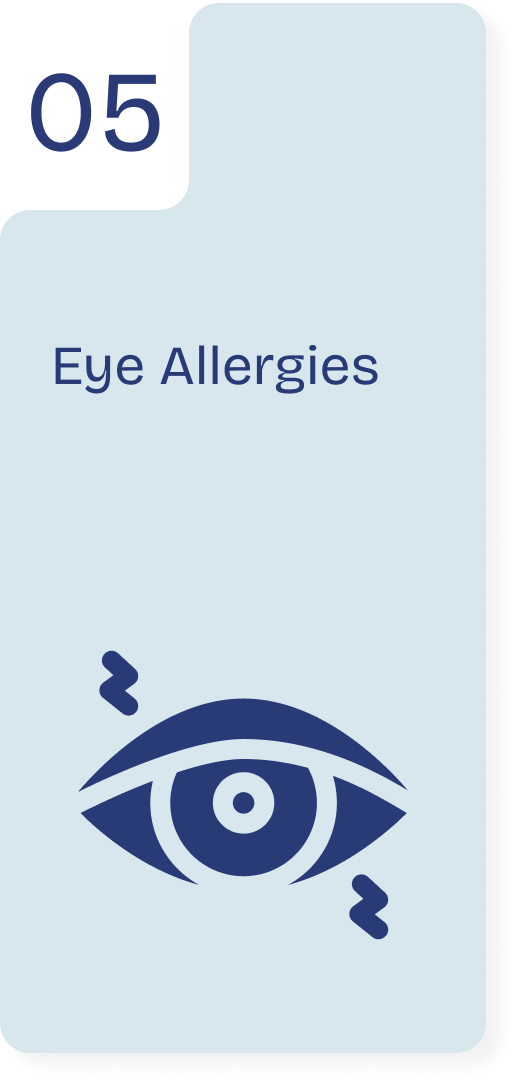 Eye Allergies